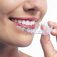 Invisalign on Staten Island